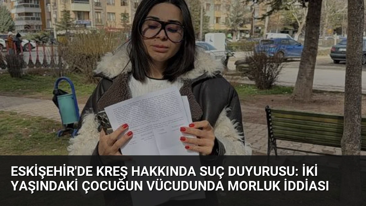 Eskişehir’de Kreş Hakkında Suç Duyurusu: İki Yaşındaki Çocuğun Vücudunda Morluk İddiası
