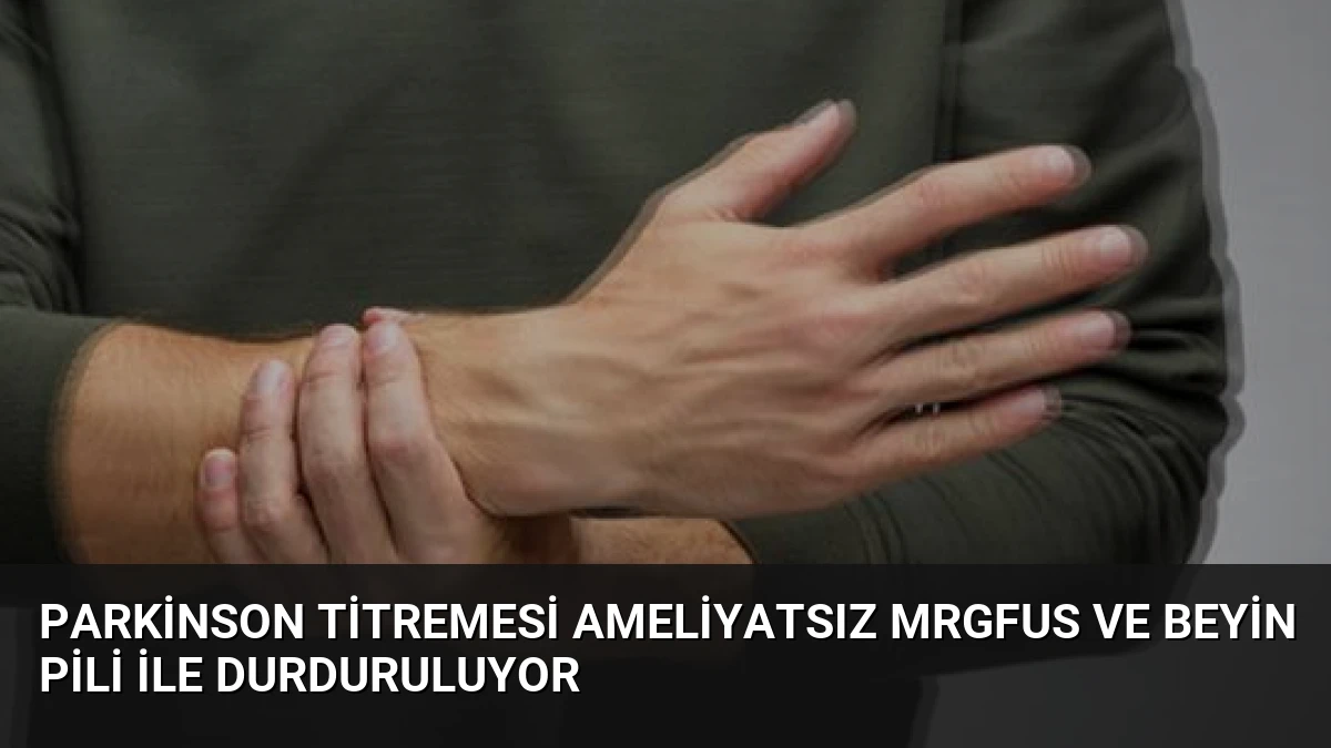 Parkinson Titremesi Ameliyatsız MRgFUS ve Beyin Pili ile Durduruluyor