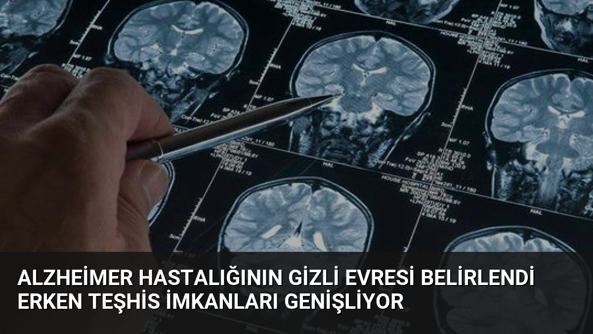 Alzheimer Hastalığının Gizli Evresi Belirlendi Erken Teşhis İmkanları Genişliyor