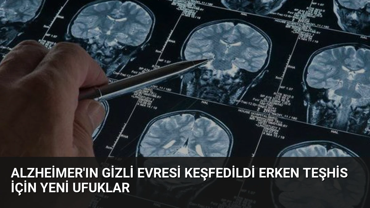 Alzheimer’ın Gizli Evresi Keşfedildi Erken Teşhis İçin Yeni Ufuklar
