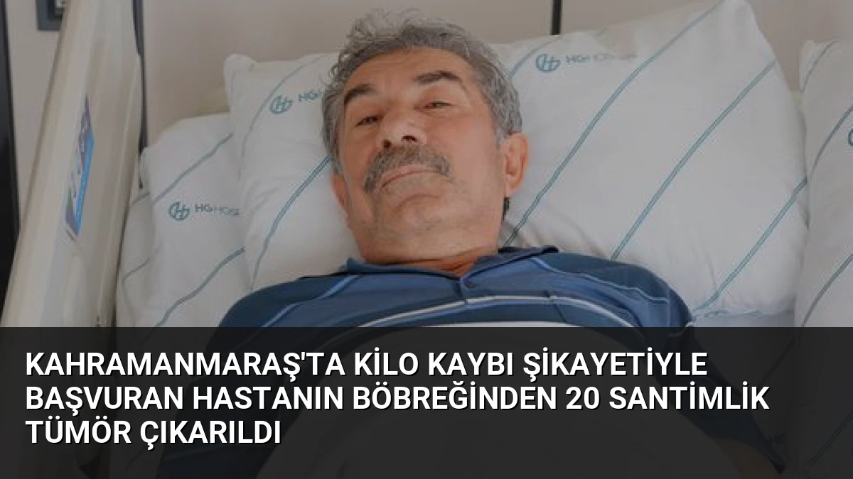 Kahramanmaraş’ta Kilo Kaybı Şikayetiyle Başvuran Hastanın Böbreğinden 20 Santimlik Tümör Çıkarıldı