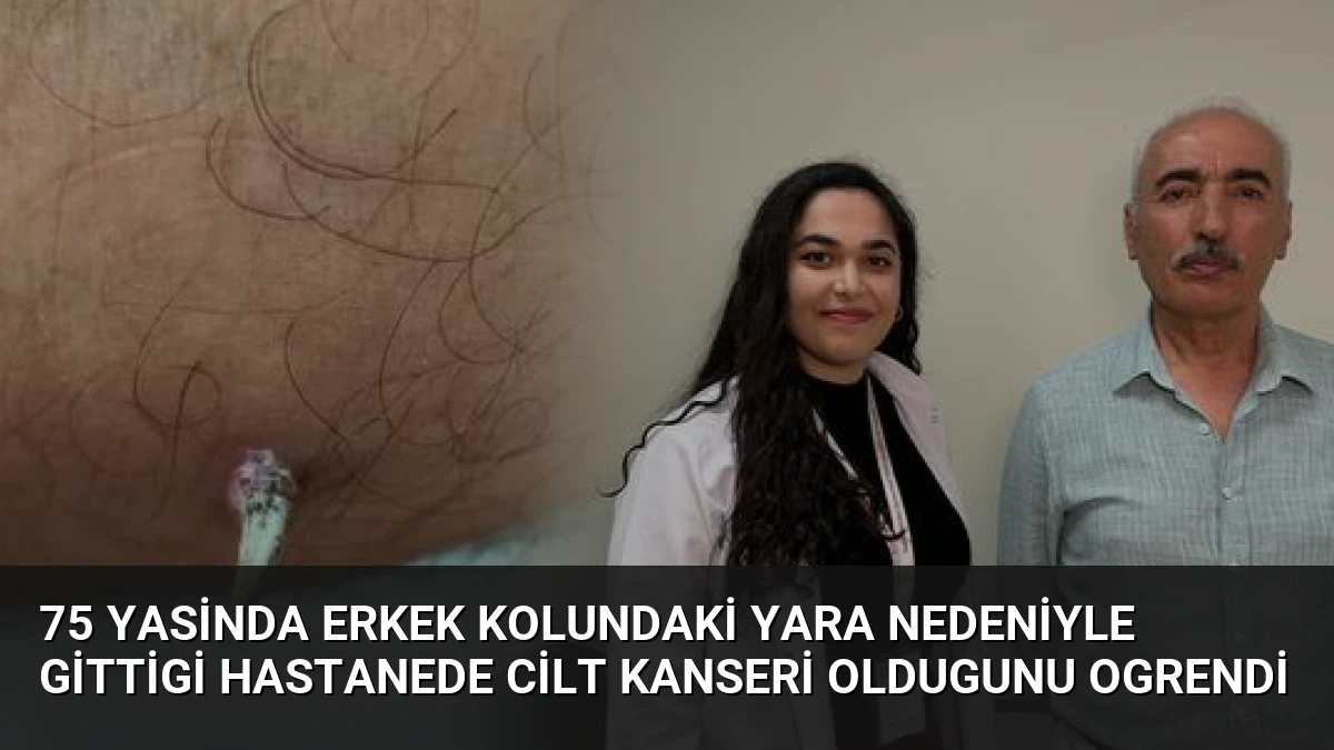 75 Yasinda Erkek Kolundaki Yara Nedeniyle Gittigi Hastanede Cilt Kanseri Oldugunu Ogrendi
