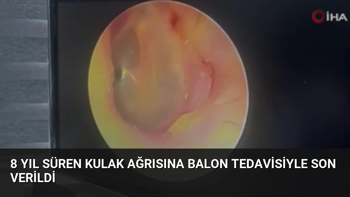 8 Yıl Süren Kulak Ağrısına Balon Tedavisiyle Son Verildi